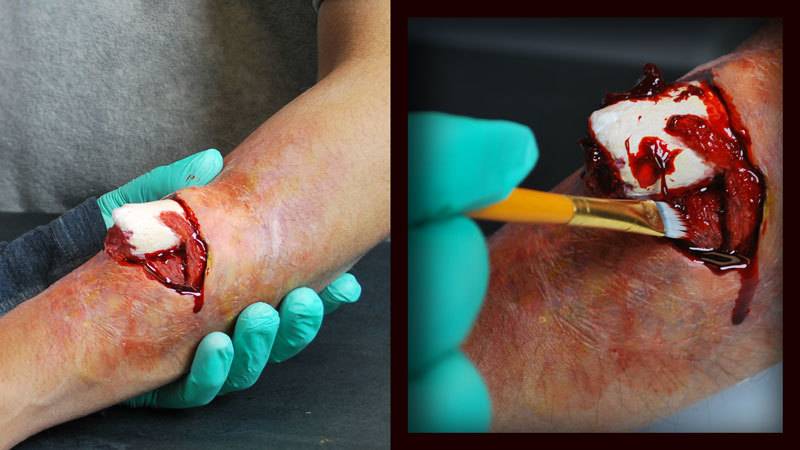 Ultimate Blood™ Kit