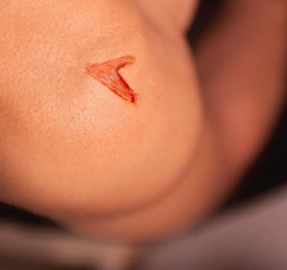 Cuts - C14 Silicone Prosthetic Mold