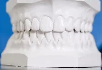 Plaster Kesan Pergigian